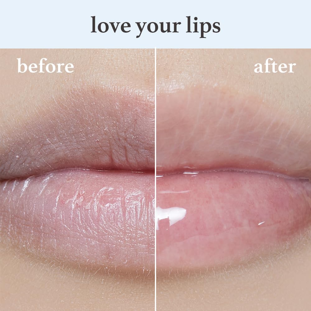 NOONI Korean Lip Oil - Appleclear | Lip Stain, Gift, Long-Lasting, Moisturizing, Plumping, Glowing, Revitalizing, and Tinting for Dry Lips with Mint Extract, 0.12 Fl Oz