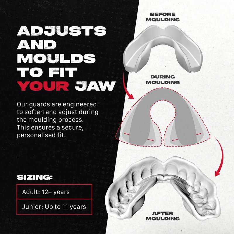 SAFEJAWZ Mouth Guard for Braces, Upper & Lower Protection Mouthguard with Case, Easy Fit Remoldable Mouthpiece for Football, Boxing, Lacrosse, MMA, Basketball & All Contact Sports (One Size, Black)