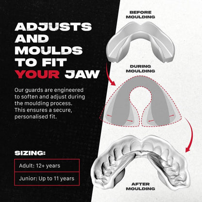 SAFEJAWZ Mouth Guard for Braces, Upper & Lower Protection Mouthguard with Case, Easy Fit Remoldable Mouthpiece for Football, Boxing, Lacrosse, MMA, Basketball & All Contact Sports (One Size, Black)