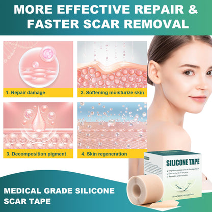 Silicone Scar Tape, Silicone Scar Sheets(1.6"X 59" Roll-1.5M), Silicone Scar Sheets for Face,Reusable Medical Grade Silicone Face Patches for Scars,C-Section,Keloid,Burn,Acne,Tummy Tuck,Surgical Scars