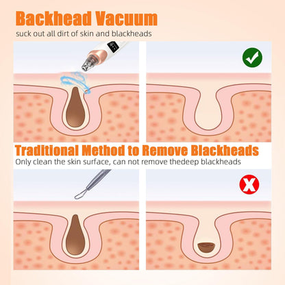 2025 Pore Vacuum, USB Rechargeable Blackhead Remover Vacuum,3 Levels Adjustable Pore Vacuum Blackhead Remover, with 5 Suction Power,6 Probes,Face Vacuum Pore Cleanser for Women & Men-White