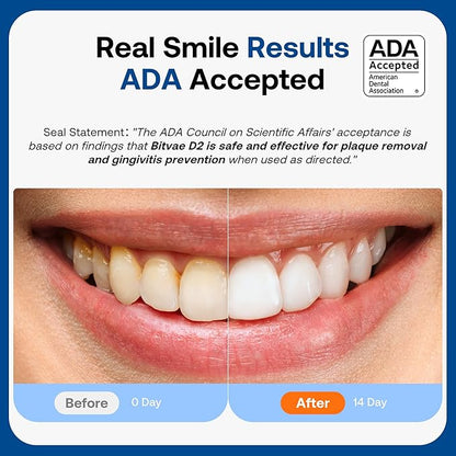 Bitvae ADA Accepted Electric Toothbrush, Travel Toothbrush Rechargeable