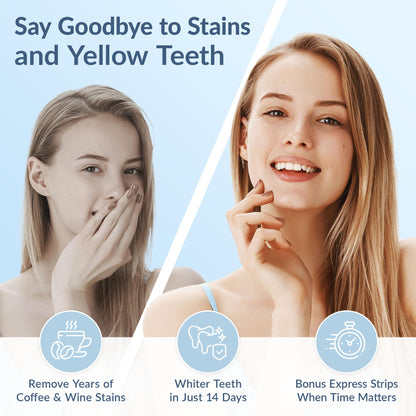 DRDENT Professional Teeth Whitening Strips - Pack of 44 Strip - 22 Treatments Kit - Safe for Enamel - Non Sensitive Teeth Whitening - Whitening Without Any Harm + Mouth Opener Included