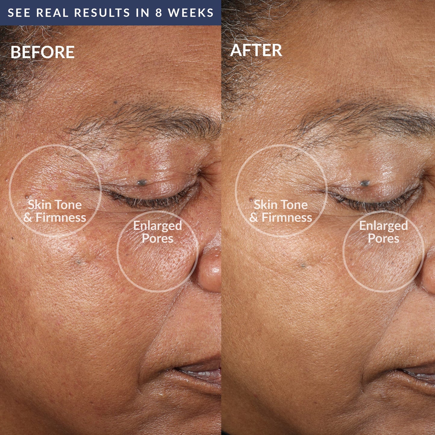 PMD Beauty Clean Pro OB - Smart Facial Cleansing Device